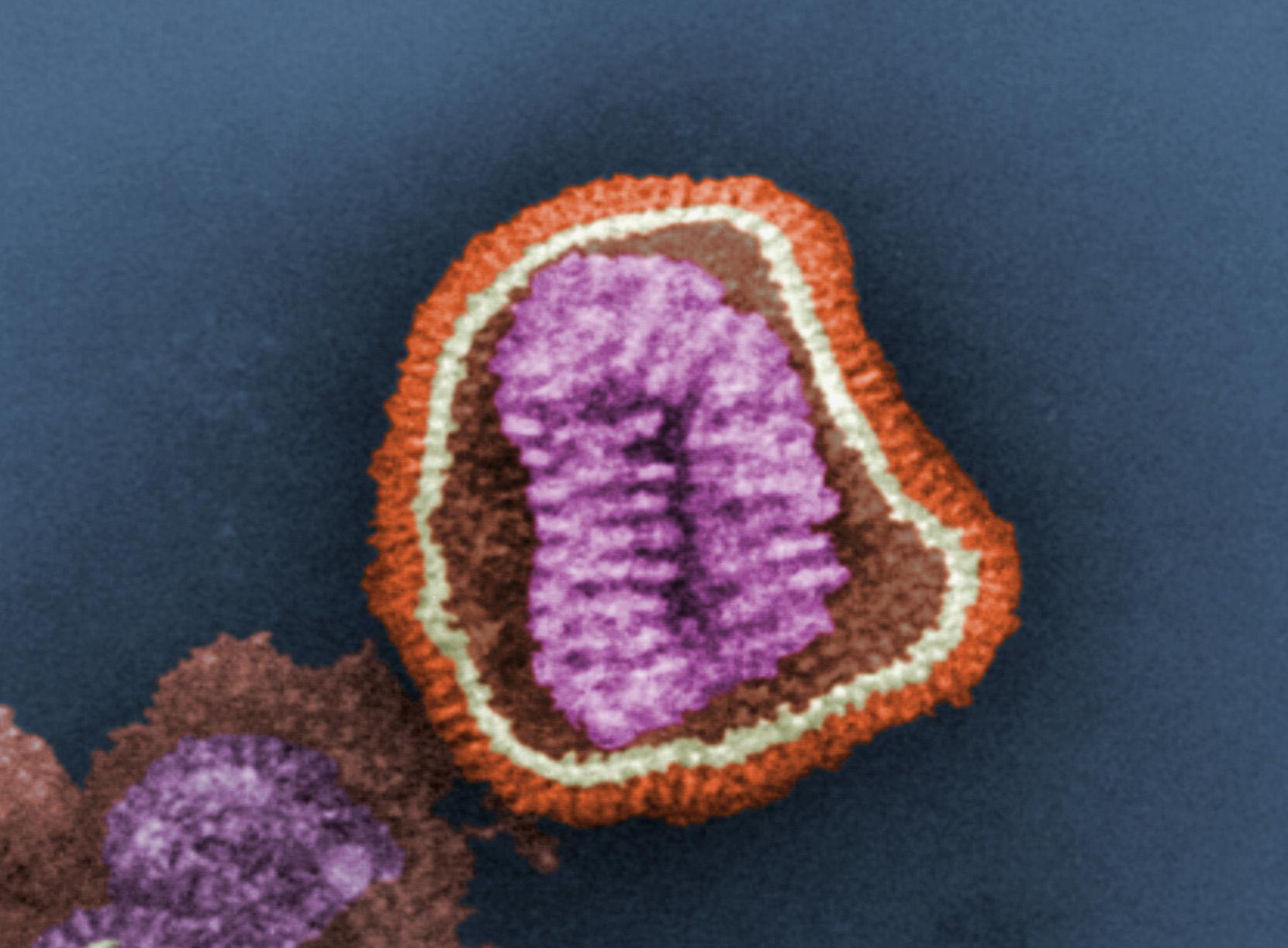 A digitally-colorized, negatively-stained transmission electron microscope image shows the details of an influenza virus particle. (Credit: CDC - Frederick Murphy)