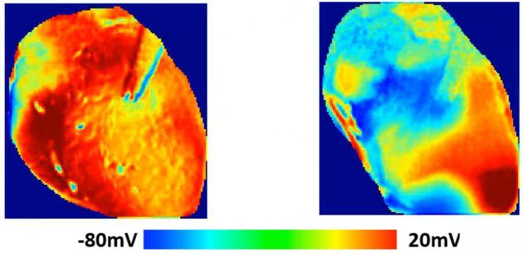 Images show the voltage surface on a rabbit heart with and without HCQ. Without the drug (left) the electrical activation spreads homogeneously, while with HCQ, waves propagate unevenly, generating complex spatiotemporal patterns and arrhythmias.